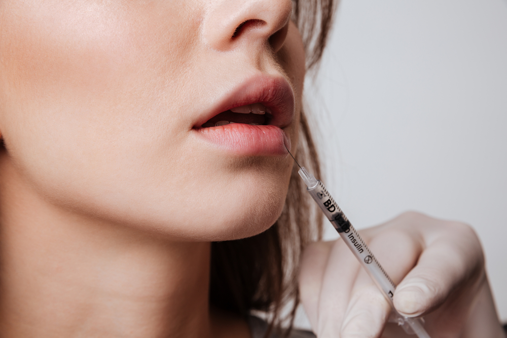 lip filler